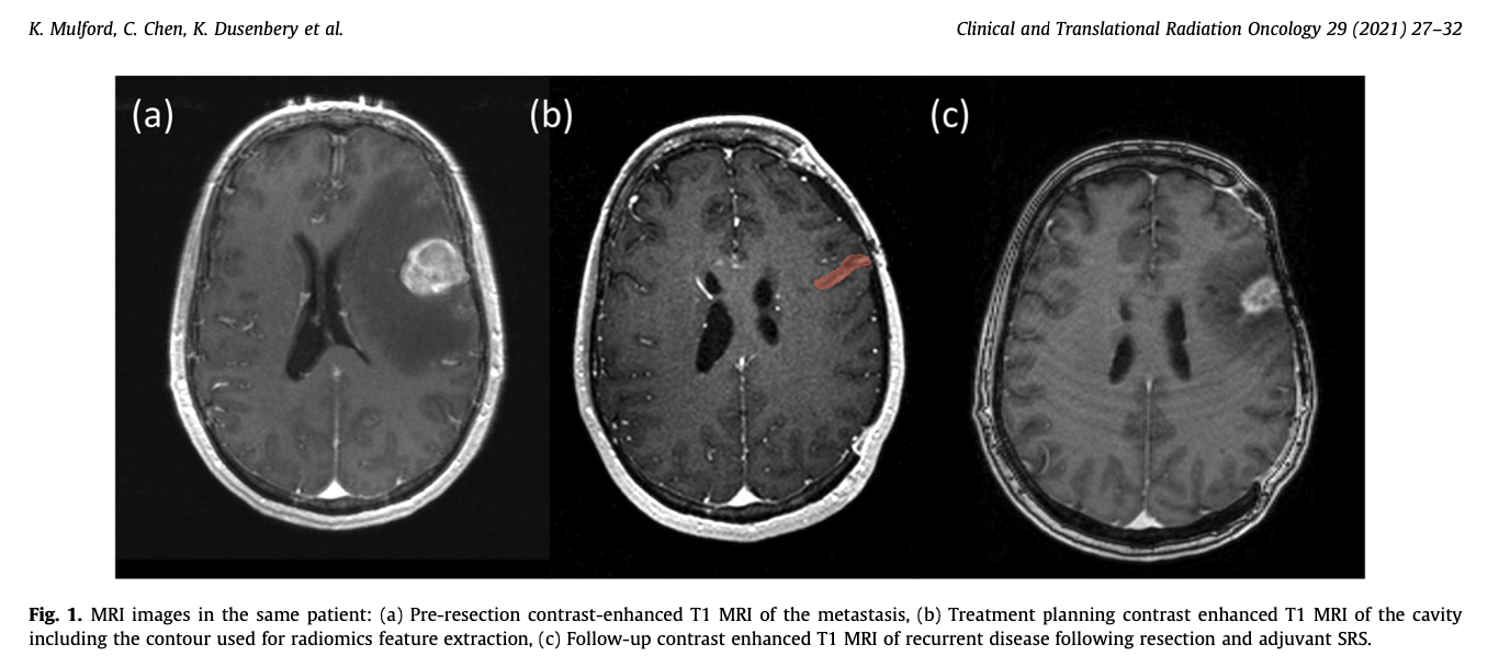 Figure 1: MRI